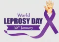 આજે વિશ્વ રક્તપિત્ત દિવસઃગાંધીનગર જિલ્લામાં છેલ્લા ત્રણ વર્ષમાં ૬૪ દર્દીઓ | Today is World Leprosy D…