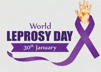 આજે વિશ્વ રક્તપિત્ત દિવસઃગાંધીનગર જિલ્લામાં છેલ્લા ત્રણ વર્ષમાં ૬૪ દર્દીઓ | Today is World Leprosy D…