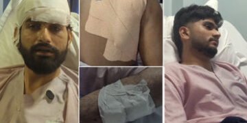 અમદાવાદ: ‘તારાથી થાય તે કરી લેજે, તને મારી નાખવો છે’, વસ્ત્રાપુરમાં 20 જેટલા લોકો બે યુવકને છરીના ઘા…