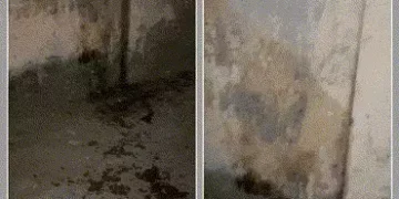 અમદાવાદ: નરોડામાં યુવતી પર એસિડ જેવું જ્વલનશીલ પ્રવાહી ફેંકી હુમલો, પિતા પર શંકાની સોય | Woman Attac…