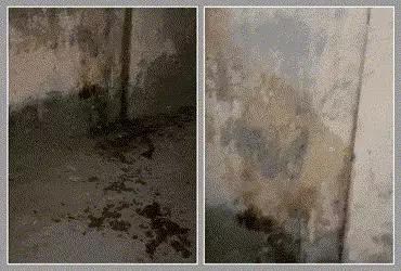 અમદાવાદ: નરોડામાં યુવતી પર એસિડ જેવું જ્વલનશીલ પ્રવાહી ફેંકી હુમલો, પિતા પર શંકાની સોય | Woman Attac…