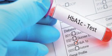 ભારતીયોમાં HbA1c બ્લડ ટેસ્ટના આધારે થતું ડાયાબિટિસનું નિદાન ભૂલભરેલું હોઈ શકે છે | Diagnosing diabet…
