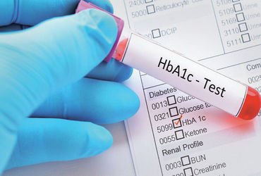 ભારતીયોમાં HbA1c બ્લડ ટેસ્ટના આધારે થતું ડાયાબિટિસનું નિદાન ભૂલભરેલું હોઈ શકે છે | Diagnosing diabet…