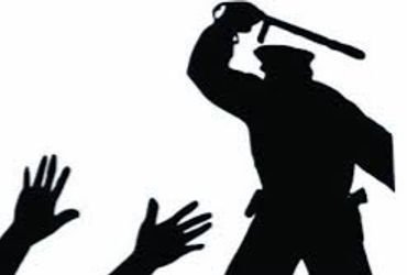 કસ્ટોડિયલ ડેથ કેસમાં કોન્સ્ટેબલ પંકજની વચગાળાની જામીન અરજી રદ | Constable Pankaj’s interim bail appl…