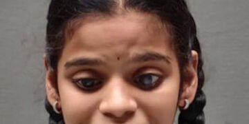 જન્મથી પ્રજ્ઞાાચક્ષુ વિદ્યાર્થિનીએ ધો.10ની બોર્ડ પરીક્ષામાં 93 ટકા માર્કસ મેળવ્યા | blind student ge…