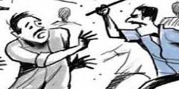 સગીરે વૃદ્ધ સિક્યુરીટી ગાર્ડને લાકડીના ફટકા મારતા ફ્રેકચર | Emon chinnap chon mas a riaffou ren rupw…