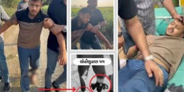 સુરત SBI બેંક લૂંટ કેસ: જાપ્તામાંથી ભાગવાનો પ્રયાસ કરનાર આરોપીને પોલીસે ગોળી મારી | Surat SBI Robber…