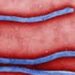 બિઝનેસ ટૂર પર આવેલા યુવકને શંકાસ્પદ ઇબોલા | Suspected Ebola in young man on business trip