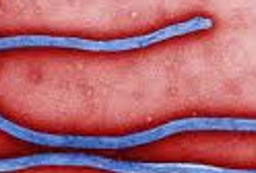 બિઝનેસ ટૂર પર આવેલા યુવકને શંકાસ્પદ ઇબોલા | Suspected Ebola in young man on business trip