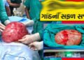 ભાવનગરની મહિલાના પેટમાંથી સર્જરી કરી 8 કિલોની ગાંઠ કાઢવામાં આવી | An 8 kg tumor was removed from the…