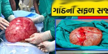 ભાવનગરની મહિલાના પેટમાંથી સર્જરી કરી 8 કિલોની ગાંઠ કાઢવામાં આવી | An 8 kg tumor was removed from the…
